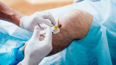 Platelet-rich plasma injection of the knee