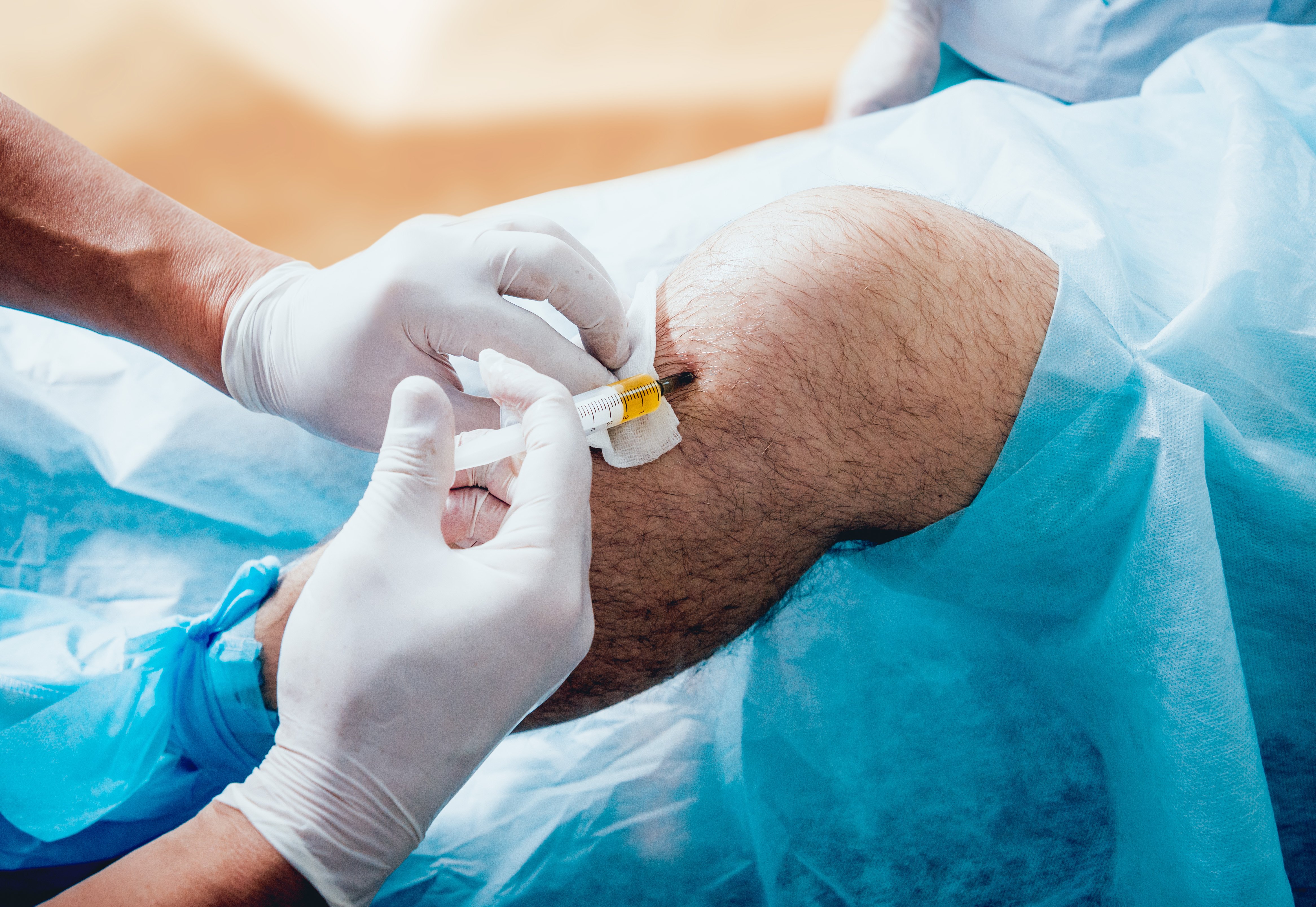 Platelet-rich plasma injection of the knee