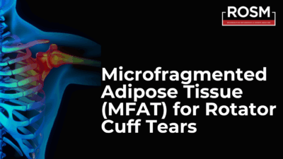MFAT for Rotator Cuff Tears