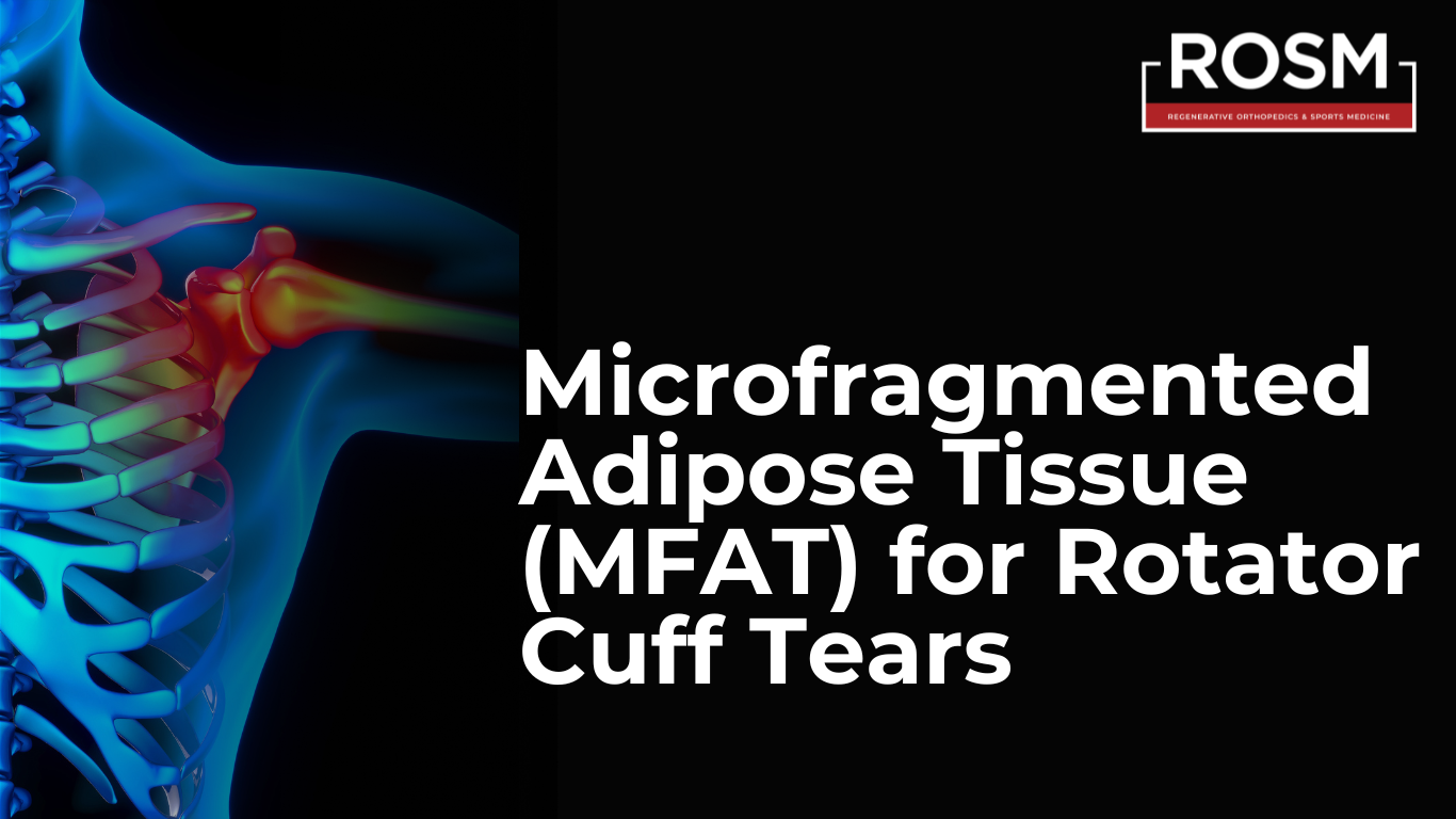 MFAT for Rotator Cuff Tears