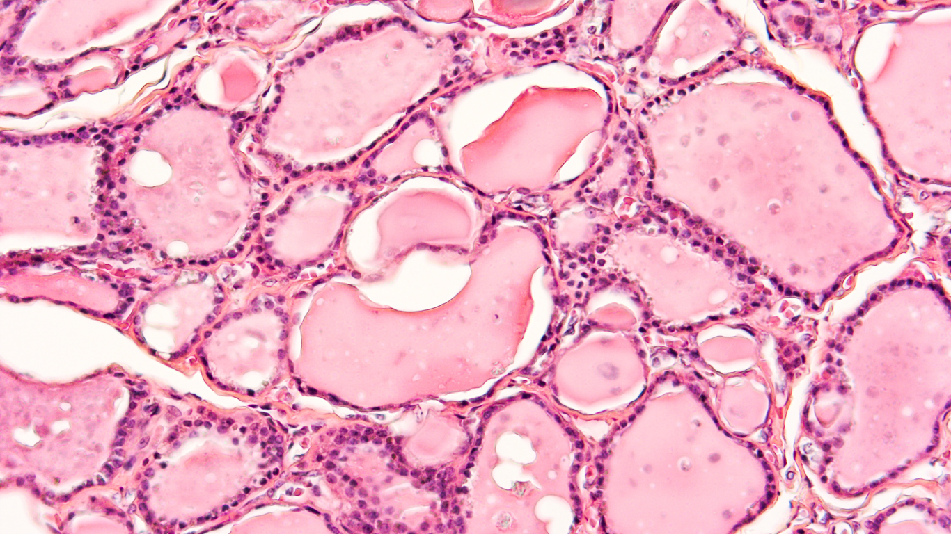 A microscopic view of human fat cells